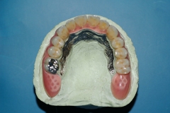 dentista-esadent-odontotecnico-odontoiatra-borgomanero-23