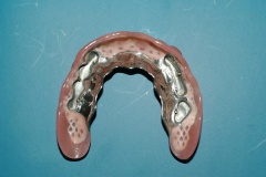 dentista-esadent-odontotecnico-odontoiatra-borgomanero-24