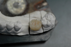 dentista-esadent-odontotecnico-odontoiatra-borgomanero-25