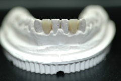 dentista-esadent-odontotecnico-odontoiatra-borgomanero-26