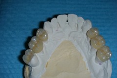 dentista-esadent-odontotecnico-odontoiatra-borgomanero-28