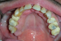 dentista-esadent-odontotecnico-odontoiatra-borgomanero-29