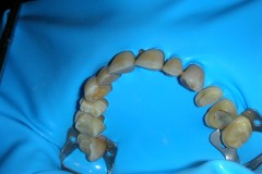 dentista-esadent-odontotecnico-odontoiatra-borgomanero-30