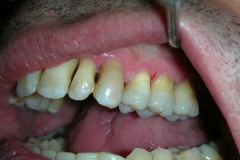 dentista-esadent-odontotecnico-odontoiatra-borgomanero-31
